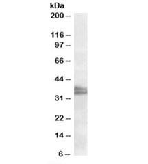 Anti-FRG1