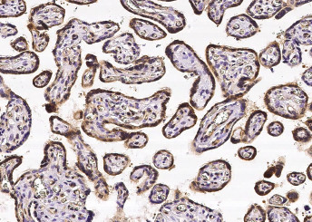 Anti-CRIP2 Monoclonal Antibody