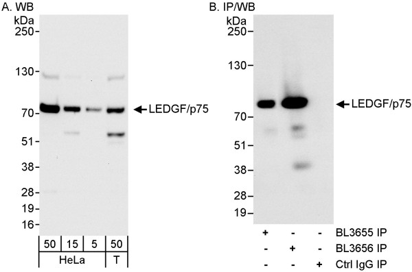 Anti-LEDGF/p75