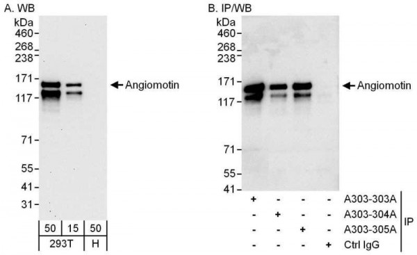 Anti-Angiomotin