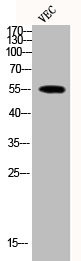 Anti-Phospho-MEF2A (T319)