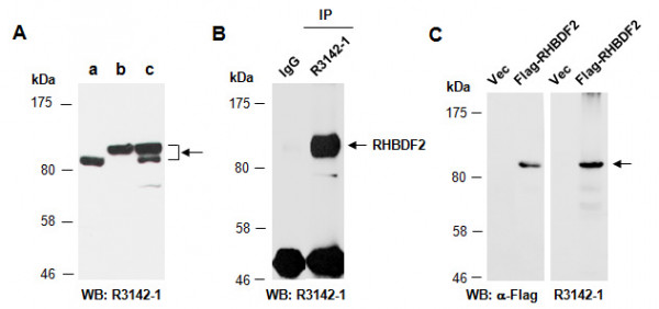 Anti-RHBDF2 (N1)