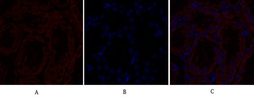 Anti-TGFBR2 / TGF beta Receptor II