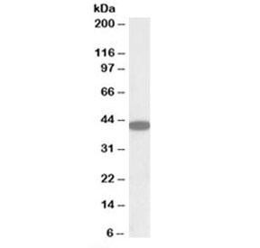 Anti-CXCR6