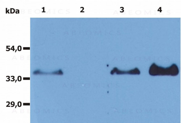 Anti-CD20 Monoclonal Antibody (Clone:MEM-97)