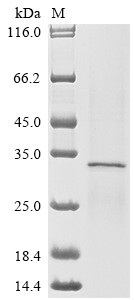 Solute carrier organic anion transporter family member 2B1 (SLCO2B1), partial, human, recombinant