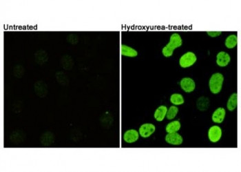 Anti-phospho-Histone H2AX (Ser139)