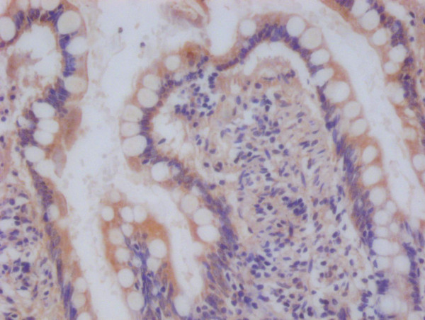 Anti-NDUFS4 Recombinant Monoclonal, clone 9H1