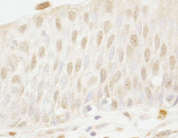 Anti-MYBBP1A (IHC)