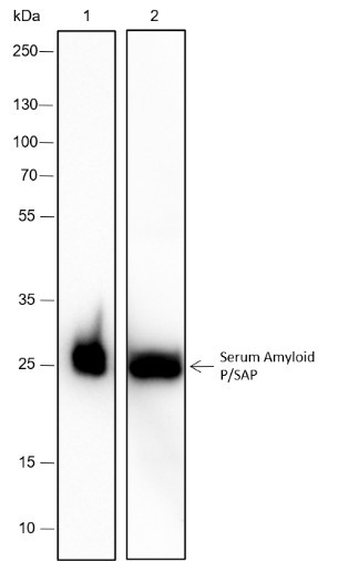 Anti-Recombinant Serum Amyloid P/SAP, clone A358