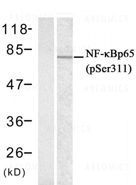 Anti-NFkB-p65((phospho-Ser311)