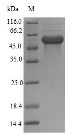 Thioredoxin-interacting protein (Txnip), mouse, recombinant