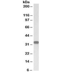 Anti-CD20