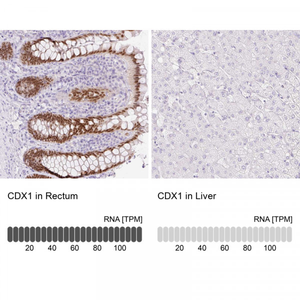 Anti-CDX1