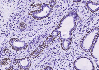 Anti-p63 (alpha) Monoclonal Recombinant Antibody