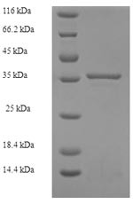 39S ribosomal protein L11, mitochondrial (MRPL11),partial, human, recombinant