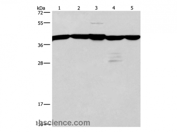 Anti-GNA13