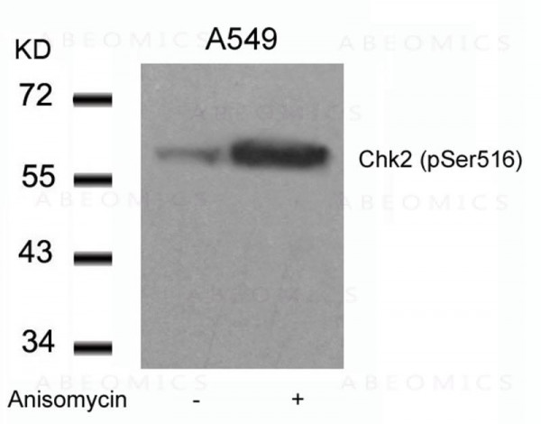 Anti-phospho-Chk2 (Ser516)