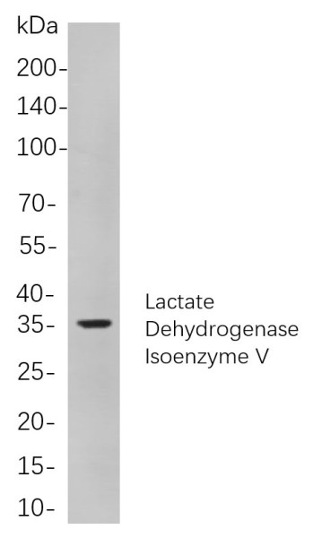 Anti-Recombinant Lactate Dehydrogenase Isoenzyme V, clone 6A4