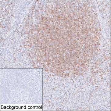 Anti-CD22
