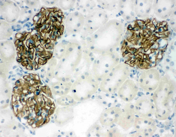Anti-NPHS2 / Podocin