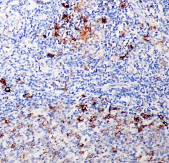 Anti-CD30, clone SQab1723