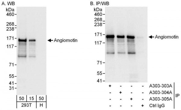 Anti-Angiomotin