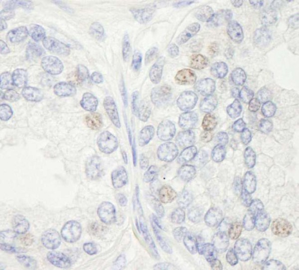 Anti-XPF/ERCC4 IHC Antibody, affinity purifie (IHC)