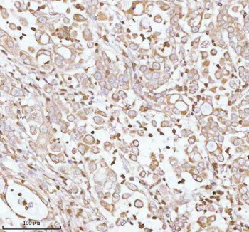 Anti-PLBD2 / Phospholipase B domain-containing protein 2