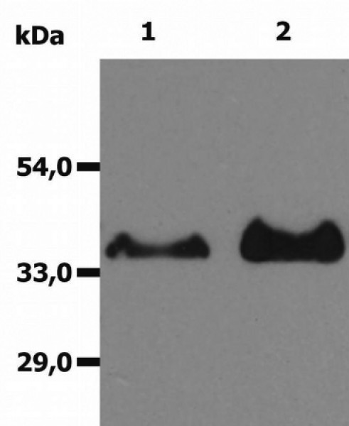 Anti-CD20, clone MEM-97 (azide free)