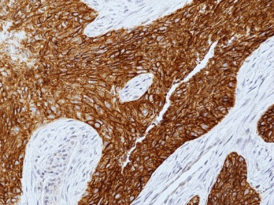 Anti-EGFR (human), Rabbit Monoclonal (RM493)