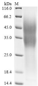 Tumor necrosis factor receptor superfamily member 10D (TNFRSF10D), partial, human, recombinant