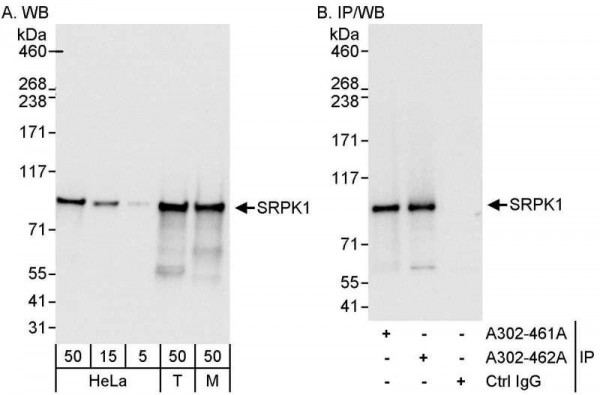 Anti-SRPK1