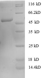 Rho GDP-dissociation inhibitor 1 (ARHGDIA), human, recombinant