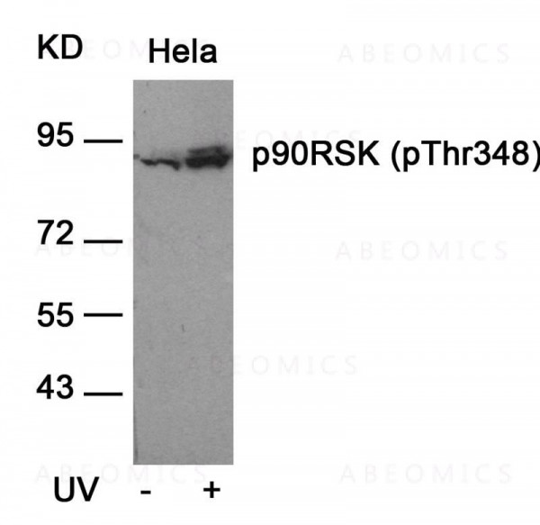 Anti-phospho-p90RSK (Thr348)