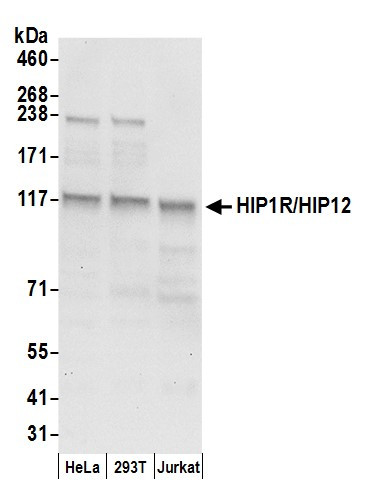 Anti-HIP1R/HIP12