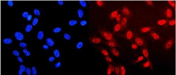 Anti-Neurofibromin / NF1