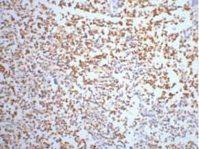 Anti-ENO2 Monoclonal