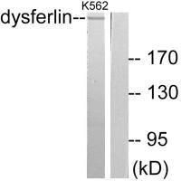 Anti-DYSF