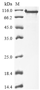 Protein phosphatase 1 regulatory subunit 15A (PPP1R15A), partial, human, recombinant