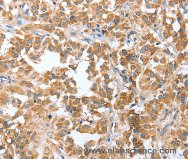 Anti-CIAPIN1