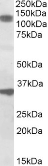 Anti-CCAR1, Internal (near C-Terminus)