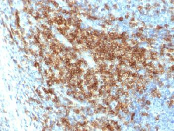 Anti-CD43 (T-Cell Marker) Recombinant Rabbit Monoclonal Antibody (clone:SPN/2049R)