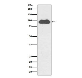 Anti-Transferrin Receptor / TFRC / CD71, clone AOAA-20