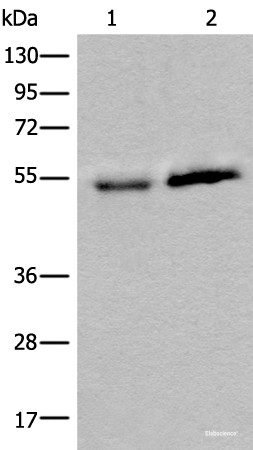 Anti-CCDC85C