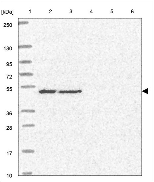 Anti-STK26