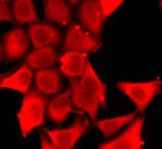 Anti-MYH1