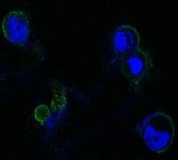 Anti-FGFR4