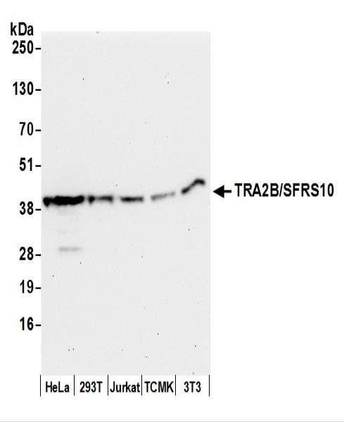 Anti-TRA2B/SFRS10