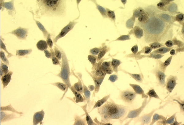 Anti-Hsp70, clone C92F3A-5